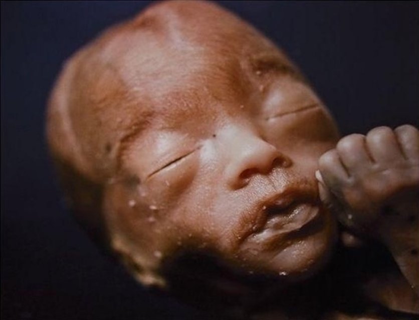 Andres Serrano, The Unborn